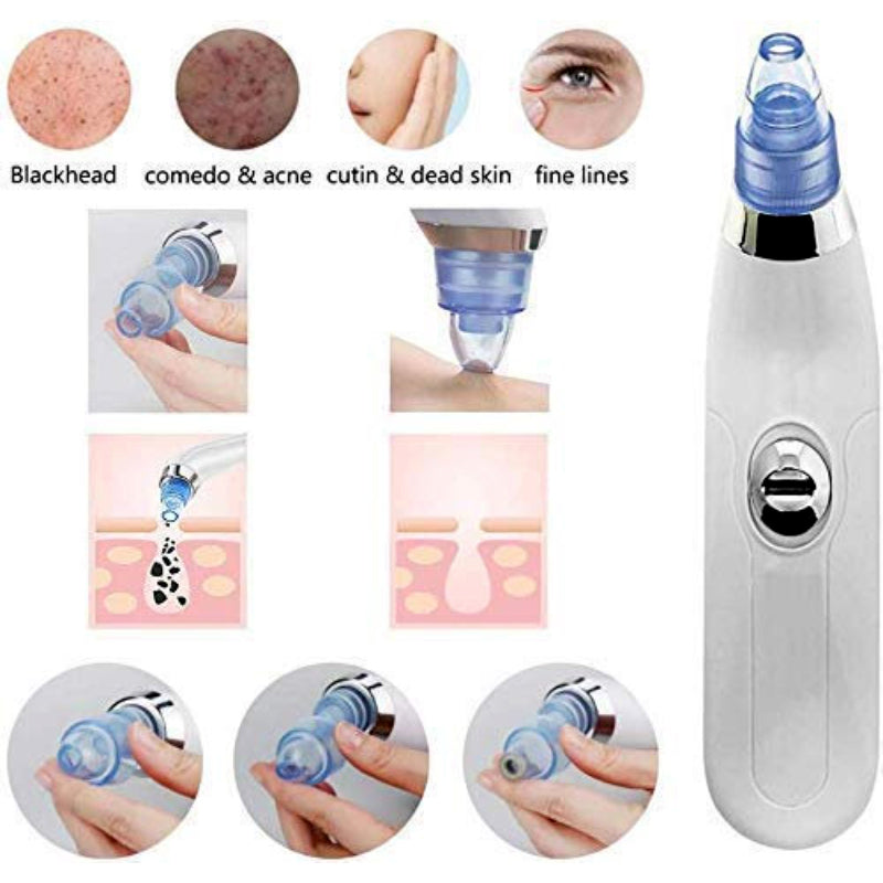 DermaSuction Multifunctional Cleaning Instrument For Pore Acne Pimple Removal and Vacuum Suction Facial Pore Cleaner Rs 1599